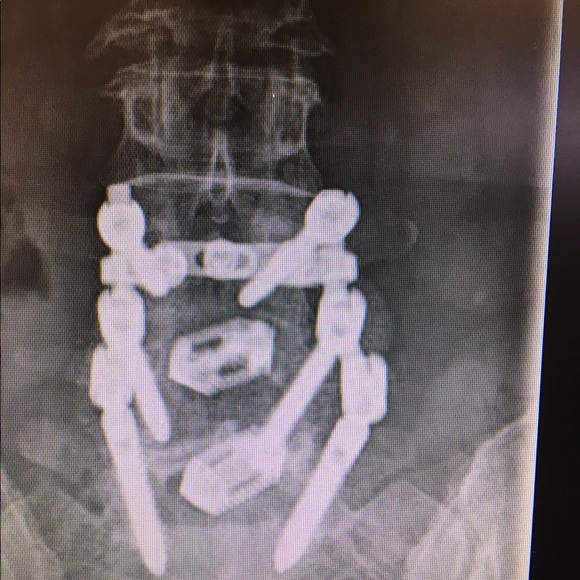 Meet your Posher, Aliceand - Picture 4 of 4